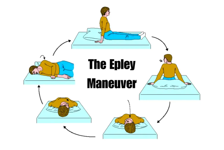 Epley's Maneuver for vertigo at Hunt Holistic Chiropractic in Lutz, FL