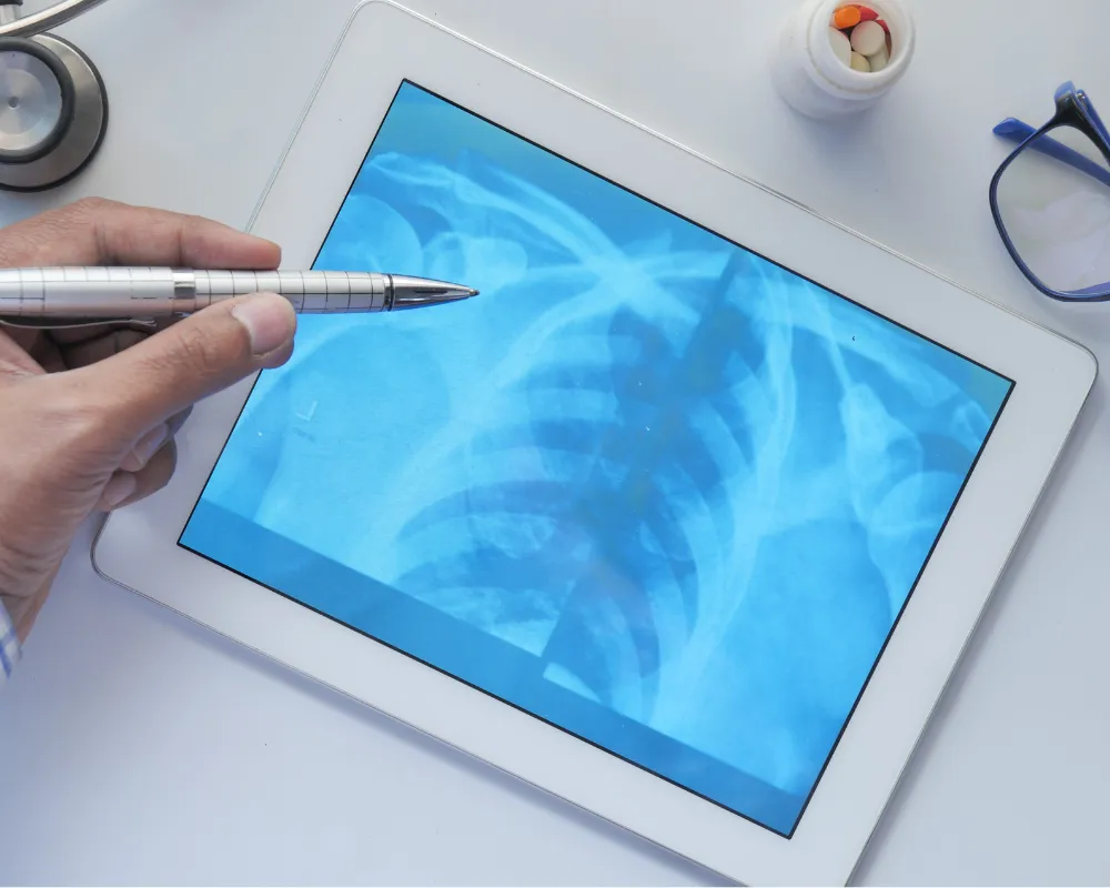 digital xray
